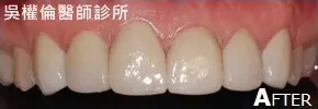 陶瓷貼片 3 3491661 orig