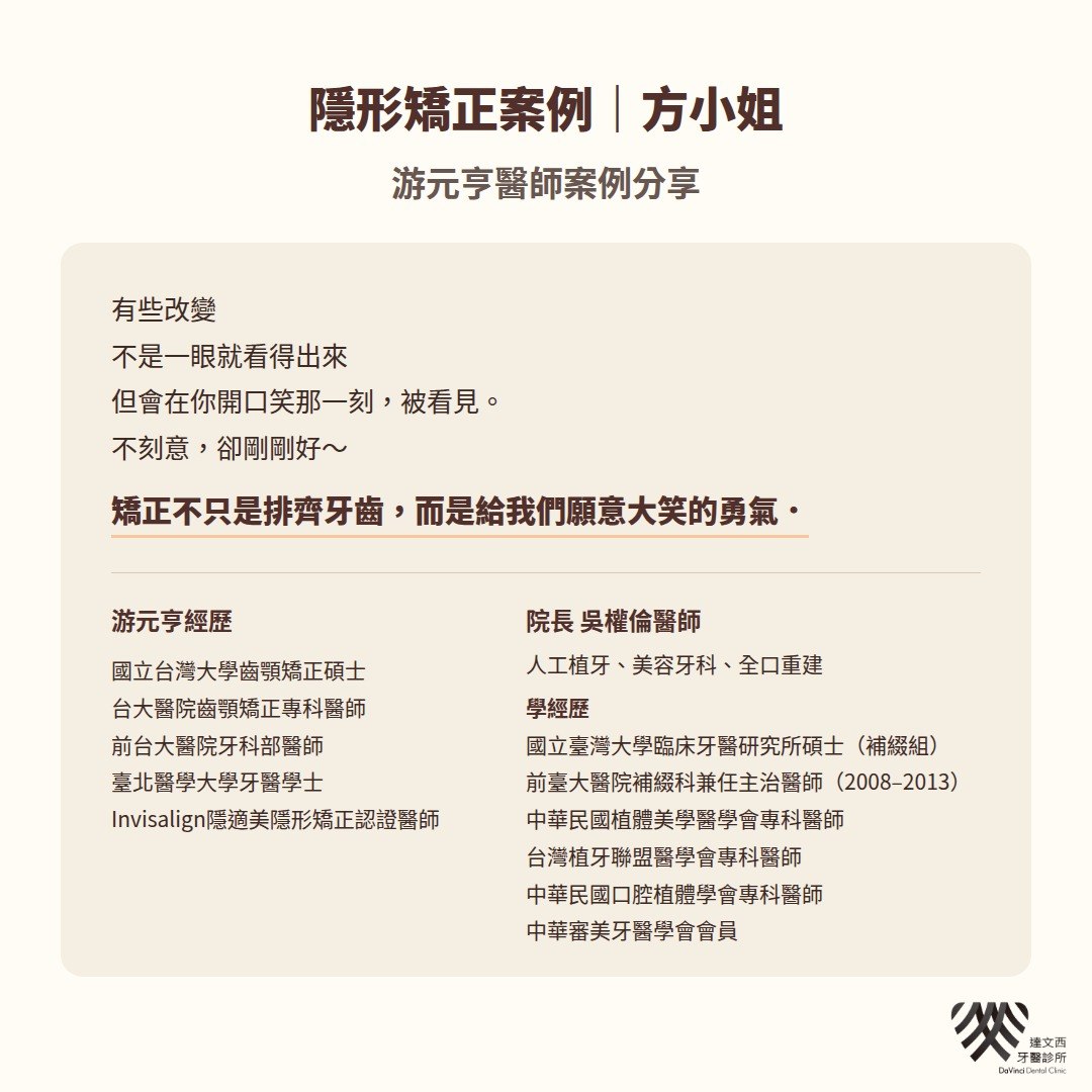 游元亨醫師-隱適美矯正案例方小姐-4